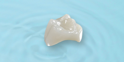 セレック治療の写真