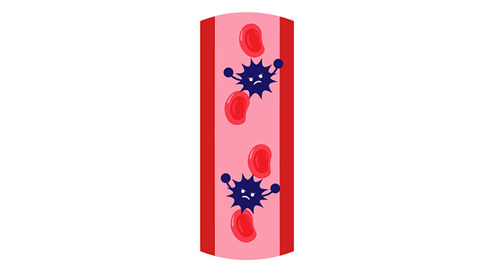 血管のトラブルを示すイラスト