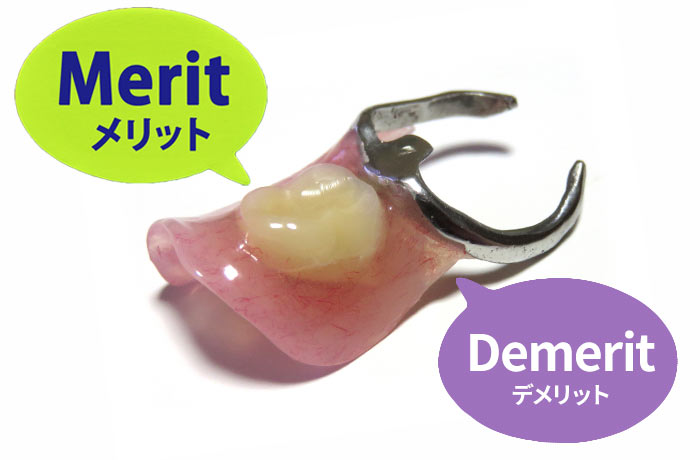 1本入れ歯の写真