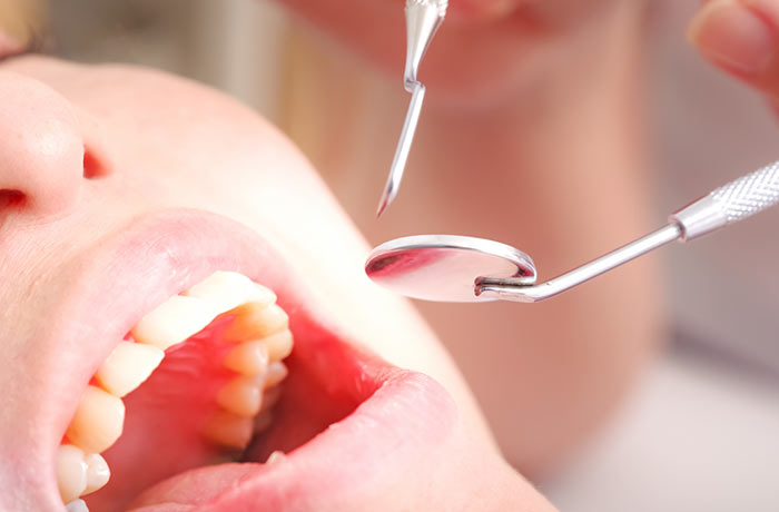 歯科治療の写真