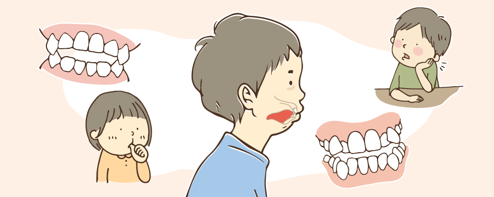 子供の歯並びの悪さは、遺伝的要因以外の原因も多い